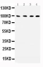 ICAM-1 (CD54) Antibody in Western Blot (WB)
