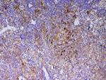 ICOS (CD278) Antibody in Immunohistochemistry (Paraffin) (IHC (P))