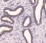 IDE Polyclonal Antibody