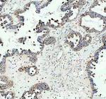 IDH2 Antibody in Immunohistochemistry (Paraffin) (IHC (P))
