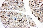 IGF1R (CD221) Antibody in Immunohistochemistry (Paraffin) (IHC (P))