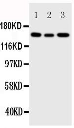 IGF1R (CD221) Antibody in Western Blot (WB)