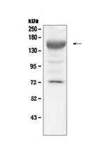 IGF1R (CD221) Antibody in Western Blot (WB)