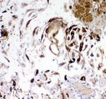 IGFBP-1 Antibody in Immunohistochemistry (Paraffin) (IHC (P))
