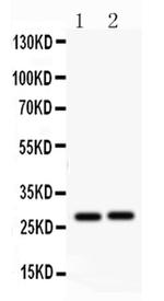 IGFBP-1 Polyclonal Antibody