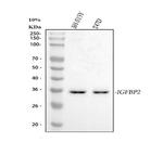 IGFBP2 Antibody in Western Blot (WB)