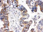 IGFBP3 Polyclonal Antibody