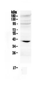 IGFBP3 Polyclonal Antibody
