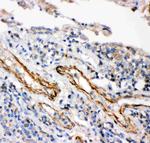 IKK beta Antibody in Immunohistochemistry (Paraffin) (IHC (P))