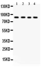 IKK beta Antibody in Western Blot (WB)
