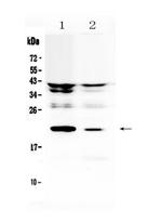 IL-11 Polyclonal Antibody
