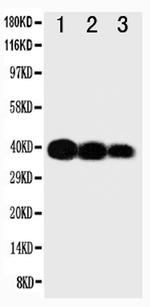 IL-12 p40 Polyclonal Antibody