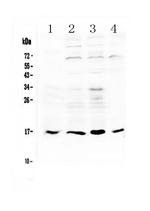 IL17B Polyclonal Antibody