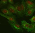 IL-18 Polyclonal Antibody