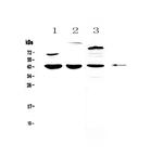 IL18BP Polyclonal Antibody