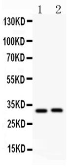 IL-1 beta Polyclonal Antibody