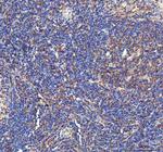 IL-1 beta Polyclonal Antibody