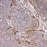 IL1F10 Polyclonal Antibody
