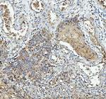 IL1RA Polyclonal Antibody