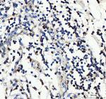 CD25 Antibody in Immunohistochemistry (Paraffin) (IHC (P))