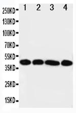 CD123 Antibody in Western Blot (WB)