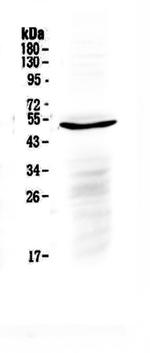 IL-6 Receptor (CD126) Polyclonal Antibody