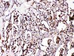 ISL1 Polyclonal Antibody