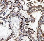CD49c (Integrin alpha 3) Antibody in Immunohistochemistry (Paraffin) (IHC (P))