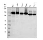 CD49c (Integrin alpha 3) Antibody in Western Blot (WB)