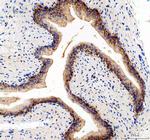 CD49e (Integrin alpha 5) Antibody in Immunohistochemistry (Paraffin) (IHC (P))