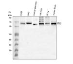 CD49e (Integrin alpha 5) Antibody in Western Blot (WB)