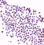 CD11a Polyclonal Antibody