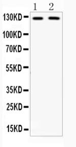 CD11b Antibody in Western Blot (WB)