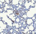 CD61 (Integrin beta 3) Antibody in Immunohistochemistry (Paraffin) (IHC (P))