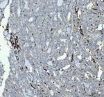 CD61 (Integrin beta 3) Antibody in Immunohistochemistry (Paraffin) (IHC (P))