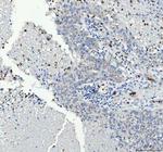 CD61 (Integrin beta 3) Antibody in Immunohistochemistry (Paraffin) (IHC (P))