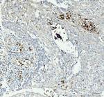 CD61 (Integrin beta 3) Polyclonal Antibody