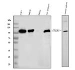 CD61 (Integrin beta 3) Antibody in Western Blot (WB)