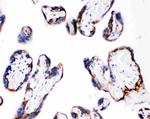 CD104 (Integrin beta 4) Antibody in Immunohistochemistry (Paraffin) (IHC (P))