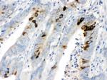 ITLN1 Antibody in Immunohistochemistry (Paraffin) (IHC (P))