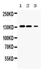 JAK1 Polyclonal Antibody