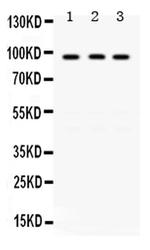 GCN5 Polyclonal Antibody