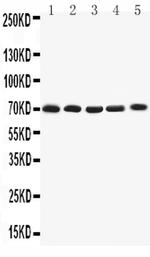 KV1.4 (KCNA4) Polyclonal Antibody