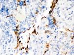 KV1.4 (KCNA4) Polyclonal Antibody