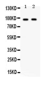 CIP2A Antibody in Western Blot (WB)