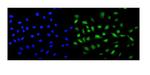 MCAK Polyclonal Antibody