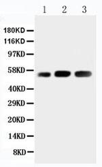 KIN Antibody in Western Blot (WB)