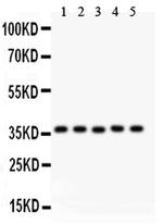 KLF6 Polyclonal Antibody