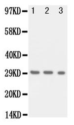 Kallikrein 1 Antibody in Western Blot (WB)
