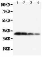 Kallikrein 1 Antibody in Western Blot (WB)